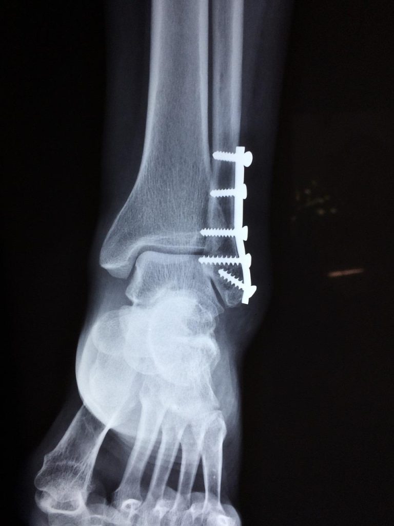 Orthopedische zorg in Houten voor gezond en actief leven - expert behandeling voor alle leeftijden